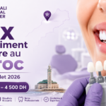 Thumbnail d’un article sur le prix du blanchiment dentaire au Maroc en 2026, avec logo Bekkali Dental Center, sourire blanc, teintier dentaire et fourchette de prix de 800 DH à 4 500 DH.