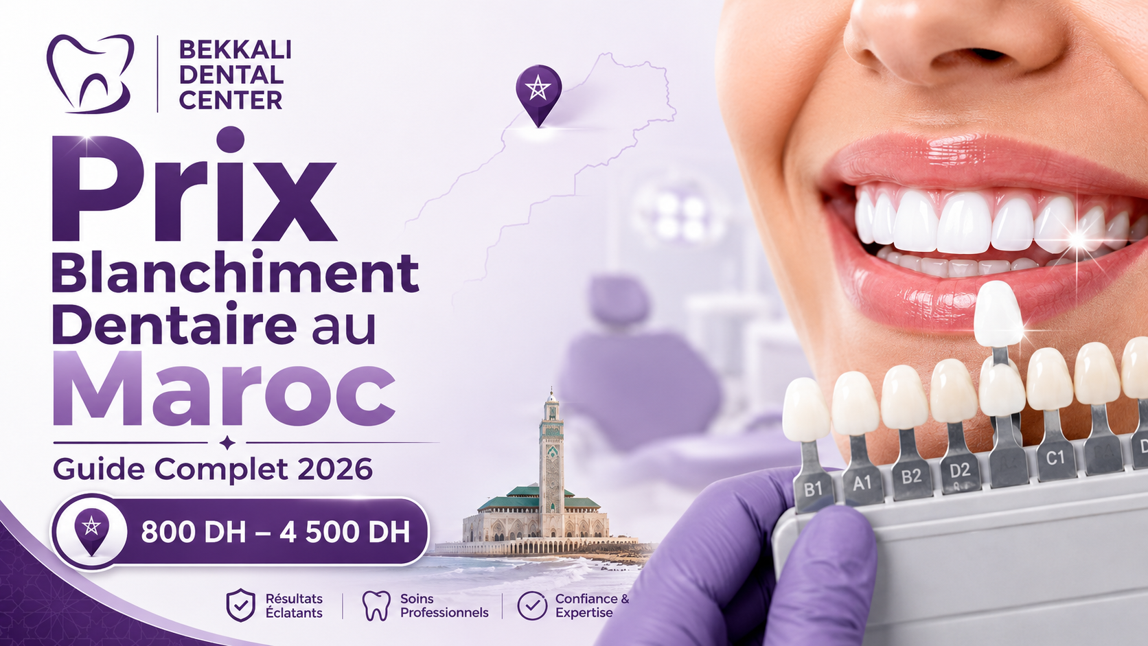 Thumbnail d’un article sur le prix du blanchiment dentaire au Maroc en 2026, avec logo Bekkali Dental Center, sourire blanc, teintier dentaire et fourchette de prix de 800 DH à 4 500 DH.