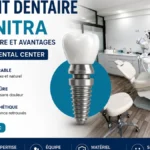 Implant dentaire à Kénitra au Bekkali Dental Center avec salle de soins moderne et solution durable