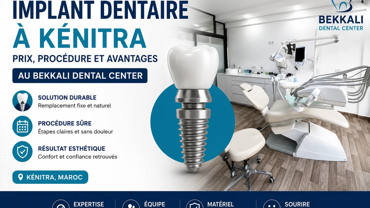 Implant dentaire à Kénitra au Bekkali Dental Center avec salle de soins moderne et solution durable