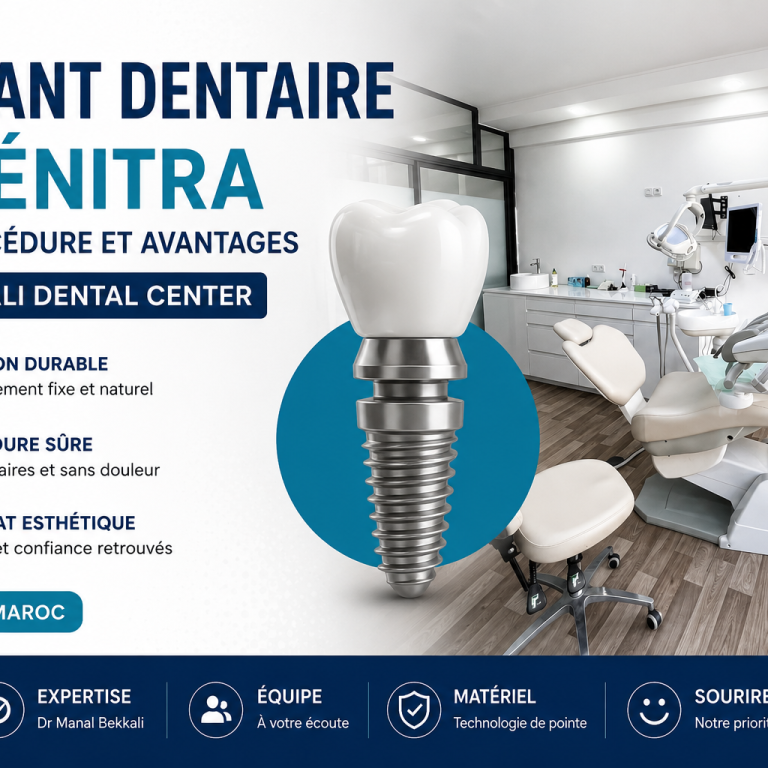 Implant dentaire à Kénitra au Bekkali Dental Center avec salle de soins moderne et solution durable