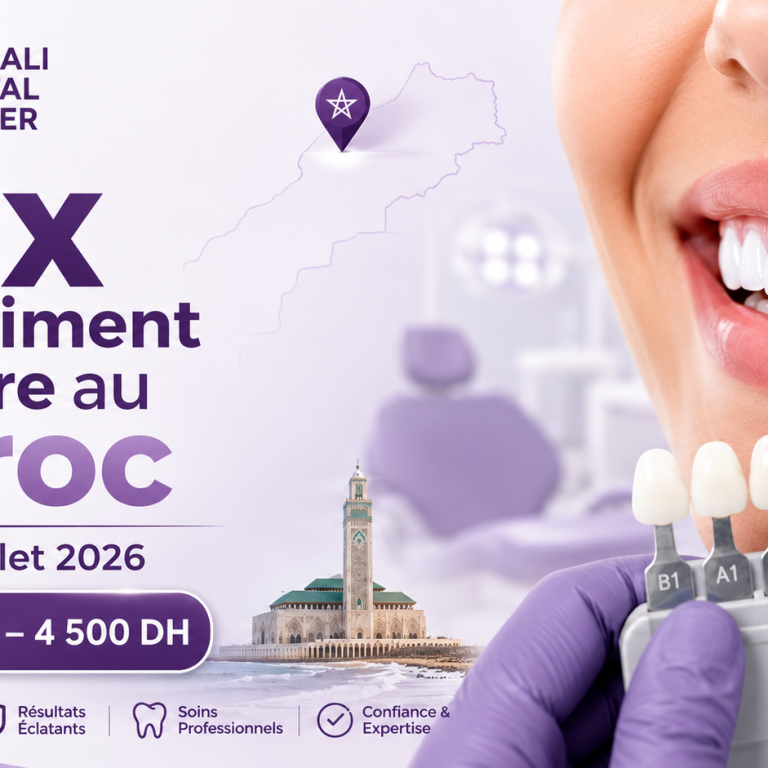 Thumbnail d’un article sur le prix du blanchiment dentaire au Maroc en 2026, avec logo Bekkali Dental Center, sourire blanc, teintier dentaire et fourchette de prix de 800 DH à 4 500 DH.